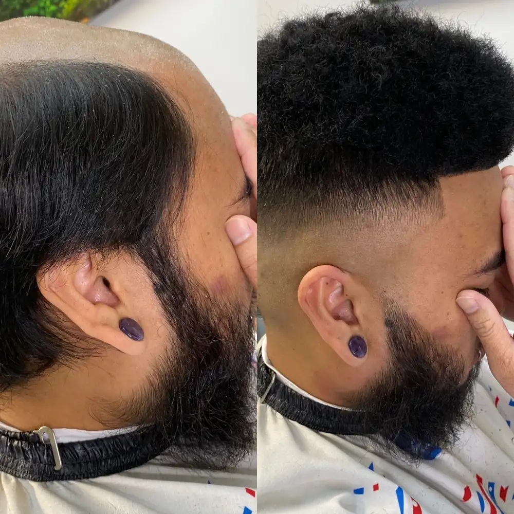 Client before and after, receded front replaced with a coily high-density hair unit over a skin fade