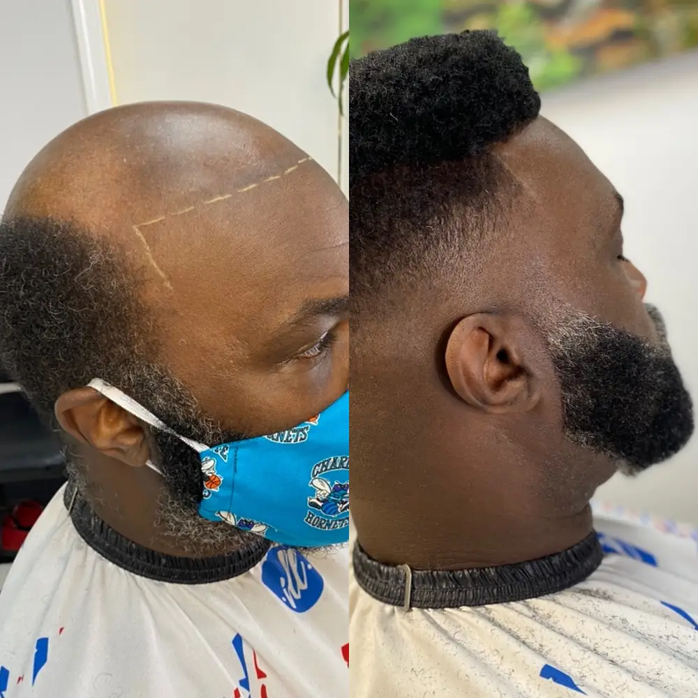 Client before and after, mapped hairline finished as a flat-top hair unit over a tight fade