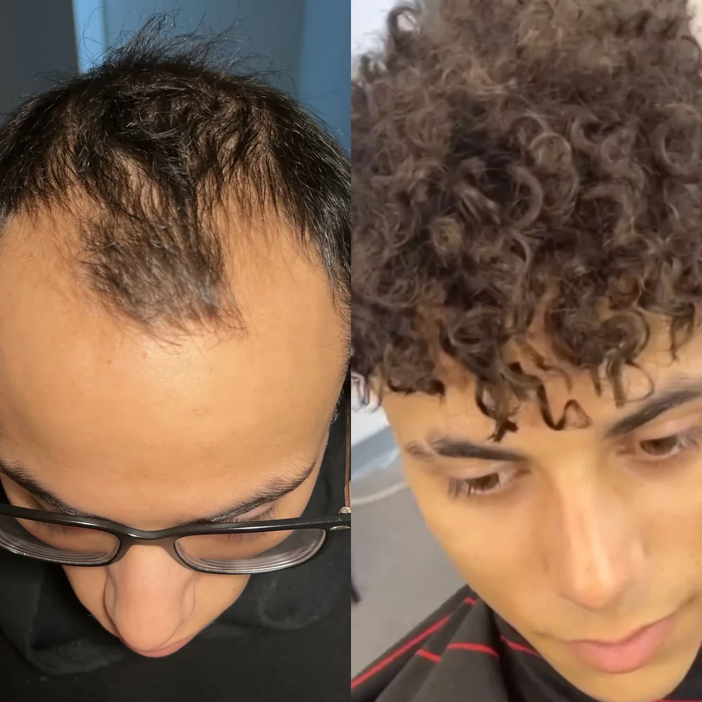 Jaedon before and after, first hair unit at 19